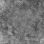 Why the Monkeypox Virus Is Not Like Covid-19
